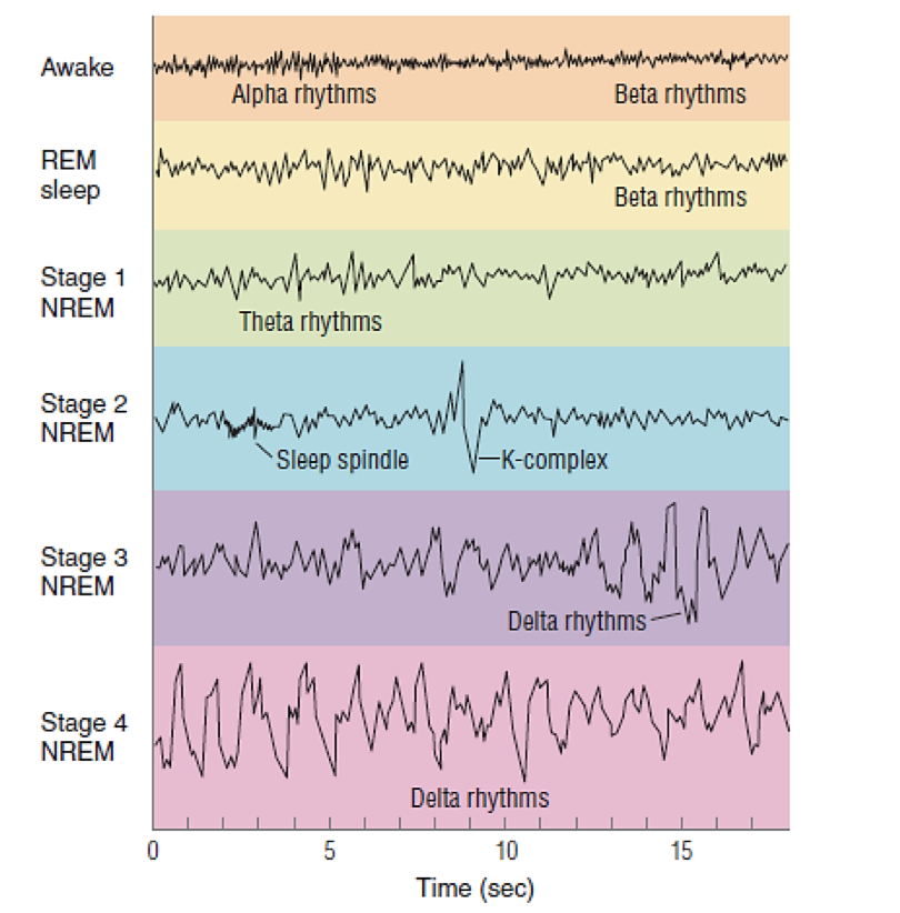 Protocolo de interpretación del EEG en epilepsia pediátrica